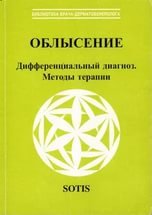 Облысение. Дифференциальный диагноз. Методы терапии