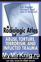A Radiologic Atlas of Abuse, Torture, Terrorism, and Inflicted Trauma